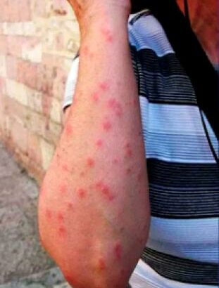 Serviços de fumigação & Limpeza ao domicílio